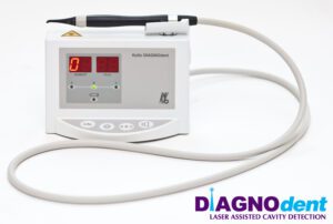 Diagnodent dental laser