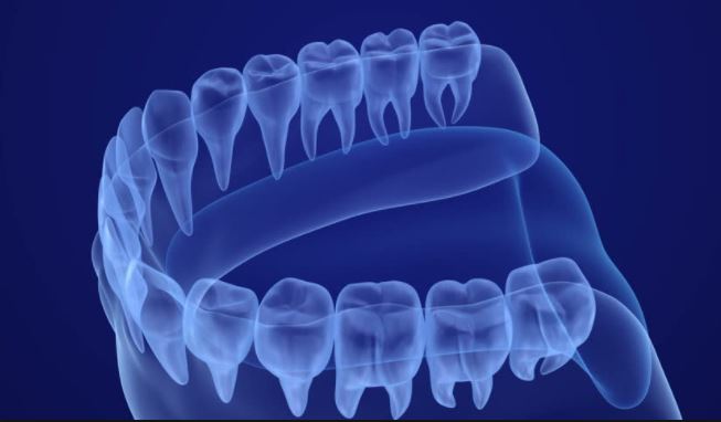 Digital x-ray and intraoral camera